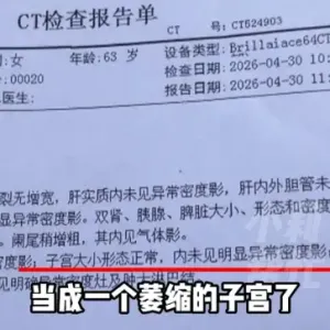 河南6旬老人子宫切除20多年，CT报告却显示“子宫大小形态正常